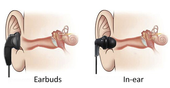 Tai nghe In-ear: Khám Phá Thế Giới Âm Thanh Riêng Tư Trong Tầm Tay